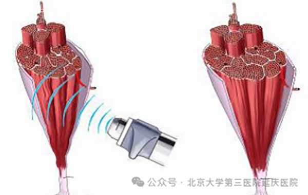 图片 4.jpg 图片 4.jpg