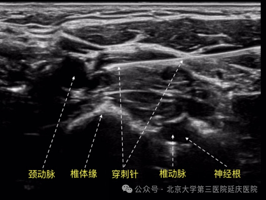 图片23.jpg 图片23.jpg